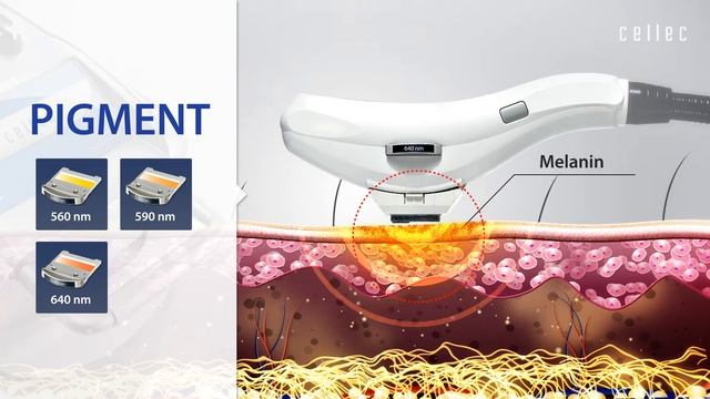 Cellec l IPL device for Acne, Pigment, Hair Removal, Skin Rejuvenation, Large Pore смотреть онлайн