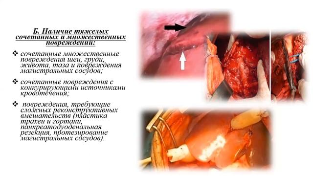 Боевая хирургическая травма. Концепция "Damage control surgery". смотреть онлайн