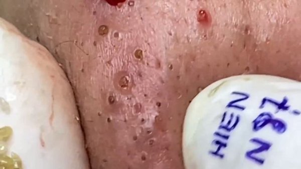 Enjoy Your Day With Hien Nguyen Spa # 1319