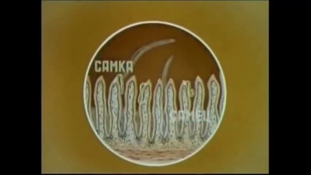 Трихинеллез у охотников смотреть онлайн