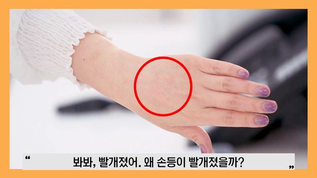[SUB]아직도 때를 벅벅 밀어요?! 스크럽을 잘못하면 각질이 일어난다!! 당신이 몰랐던 바디워시의 비밀 1등 워시만 골라줌 | #화장품은과학이다 #안언니 смотреть онлайн