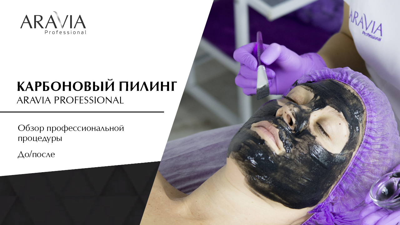 Карбоновый пилинг без лазера! Этапы профессиональной процедуры. До/после смотреть онлайн