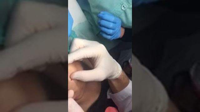 Ботокс межбровье