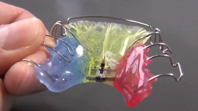 ВОПРОСЫ ОРТОДОНТУ: БРЕКЕТЫ ДЛЯ ДЕТЕЙ смотреть онлайн