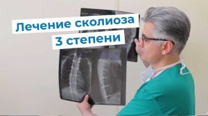 Лечение идиопатического сколиоза 3 степени | Отзыв пациента