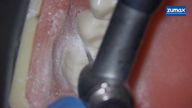 ПРЕПАРИРОВАНИЕ ПОД ПОЛНУЮ КОРОНКУ(подробная инструкция) смотреть онлайн