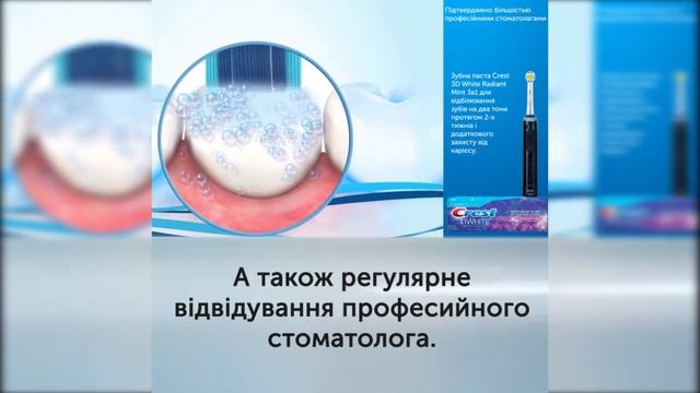 Плями на зубах причини та лікування Oral B смотреть онлайн