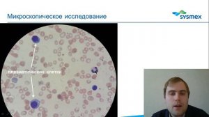 Множественная миелома