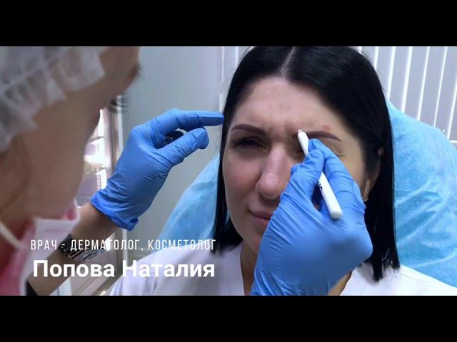 Релатокс, процедура ботулинотерапии смотреть онлайн