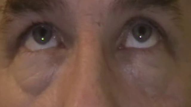 Nystagmus 1 смотреть онлайн