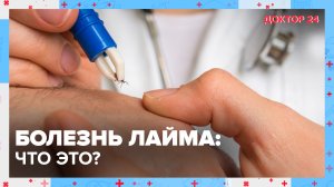 БОЛЕЗНЬ ЛАЙМА: что это? | Доктор 24