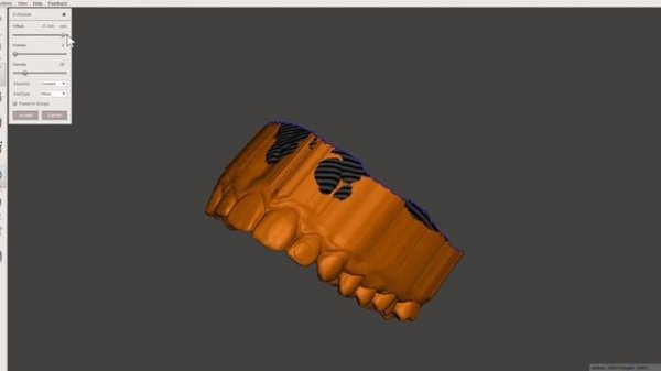 Preparing dental models in MeshMixer for 3D printing