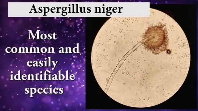 Aspergillus species microscopic appearance | Aspergillus identification (Clear explanation) смотреть онлайн