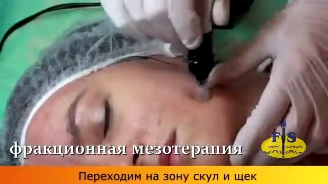 Фракционная мезотерапия - Dr.Suleymanova смотреть онлайн