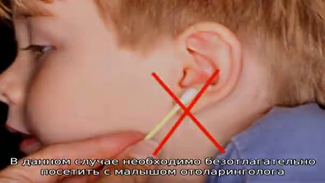 Почему происходит накопление серы в ушах у ребенка смотреть онлайн