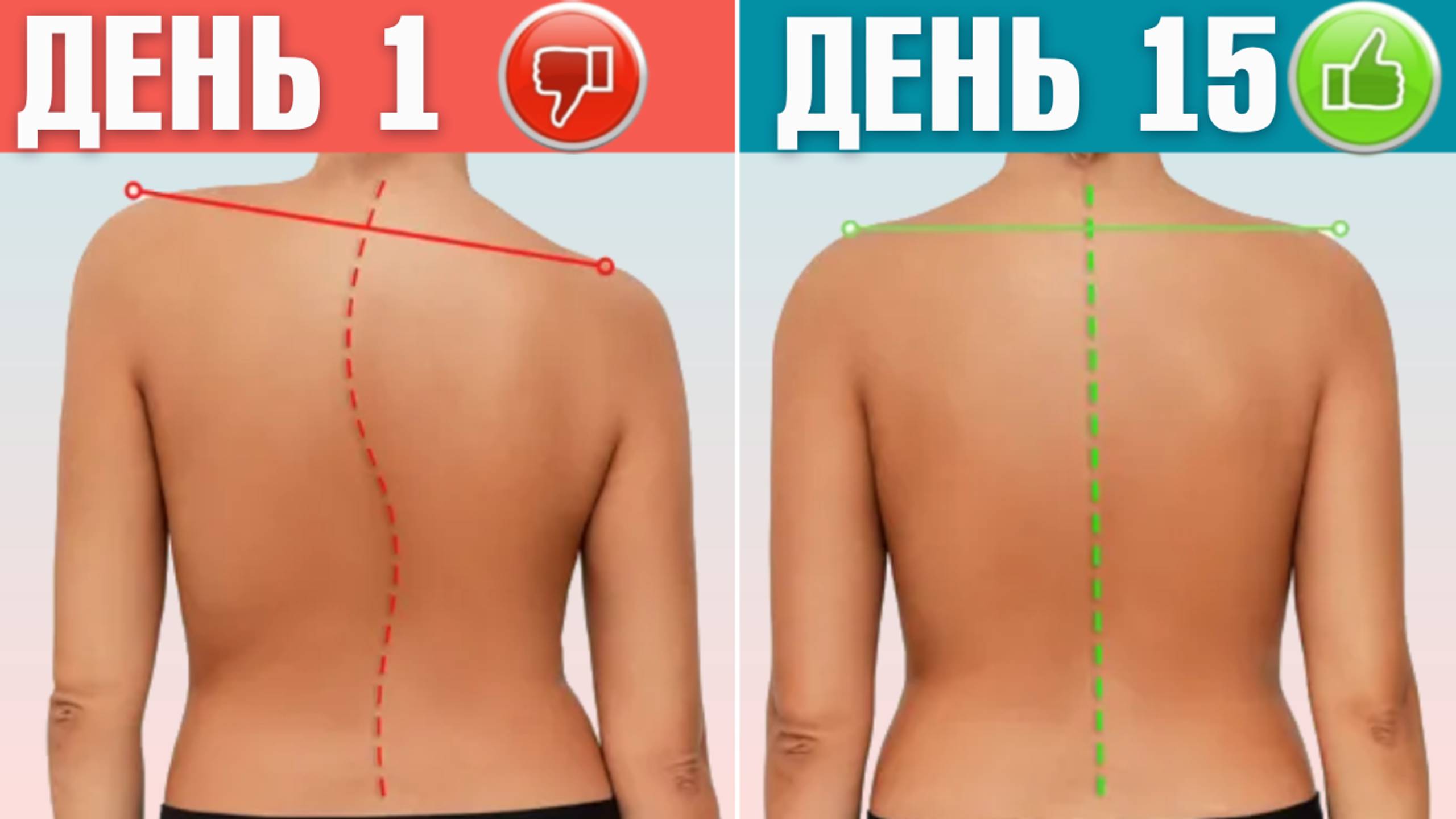 Асимметрия плеч: Как исправить за 10 минут в день? / Разная высота плеч - упражнение на исправление смотреть онлайн