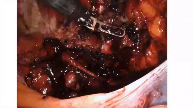 Брайан Джекоб "Паховая боль" смотреть онлайн