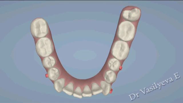 Нижняя челюсть