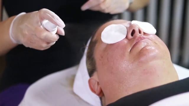 ПРОФЕССИОНАЛЬНЫЙ ПИЛИНГ TIZO® PHOTOCEUTICAL . AHA/RETINOL смотреть онлайн