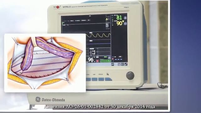 HD РЖД Хирургия 20сек