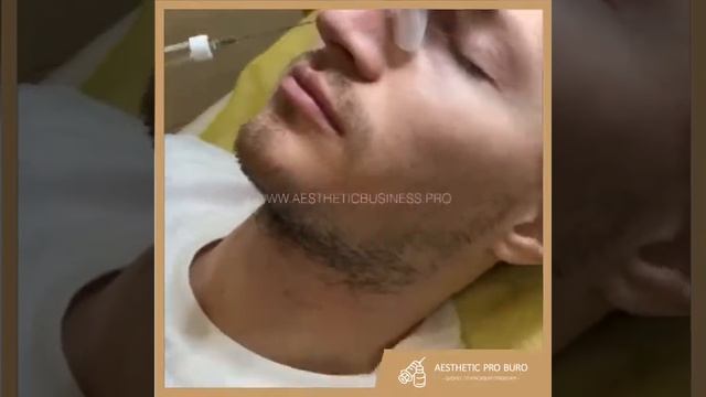 Обучение врачей-косметологов работе с мужскими лицами | AESTHETIC PRO BURO смотреть онлайн