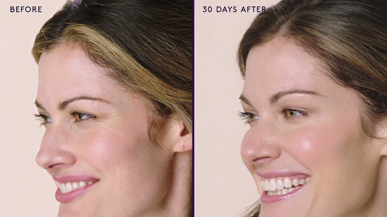 Инъекционная косметология "до-после" смотреть онлайн