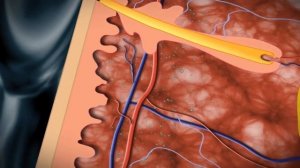 Санаторий ПОЛТАВА КРЫМ Саки