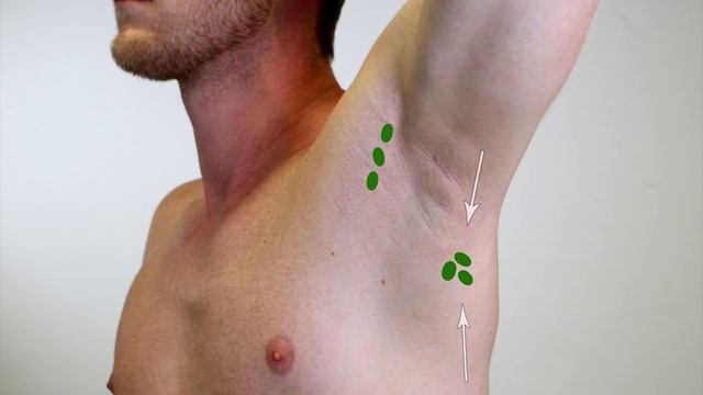 Examination of the Lymph Nodes - Clinical Examination смотреть онлайн