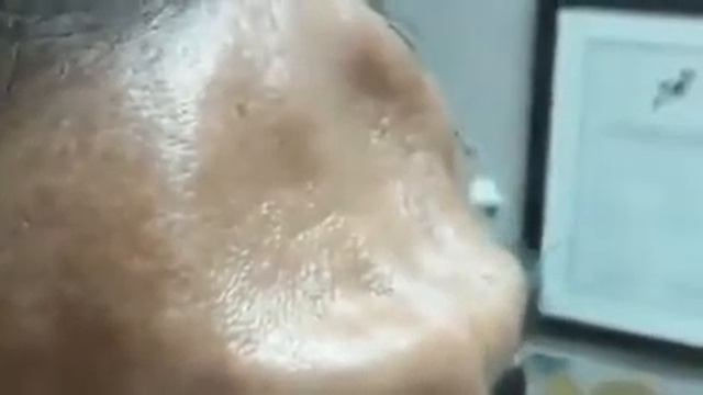 пульсация в лобной доли головы смотреть онлайн