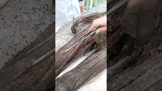 Мышцы нежный конечности