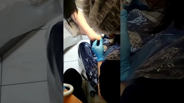"Комплексный подологический прием" PROcvet. Бережная обработка травмированных ногтей, восстановлени смотреть онлайн