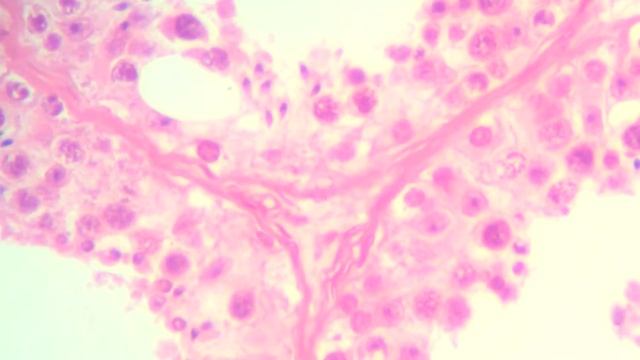 Testicle (histology). Семенник (гистология)