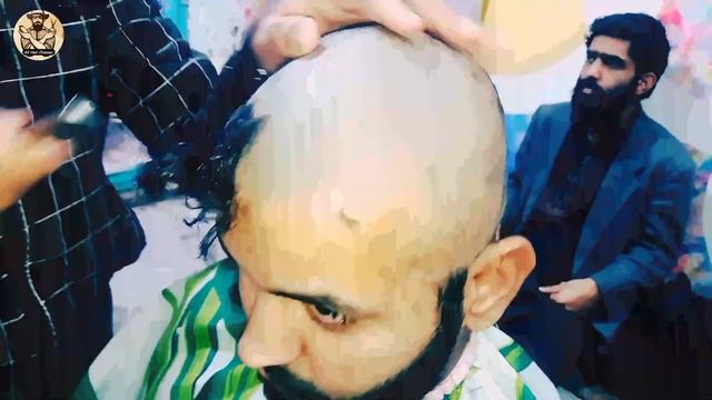 Head Shave Dandruff Target The Source To Control Dandruff 🔥how To Full Head Shave Men Tutorial2022