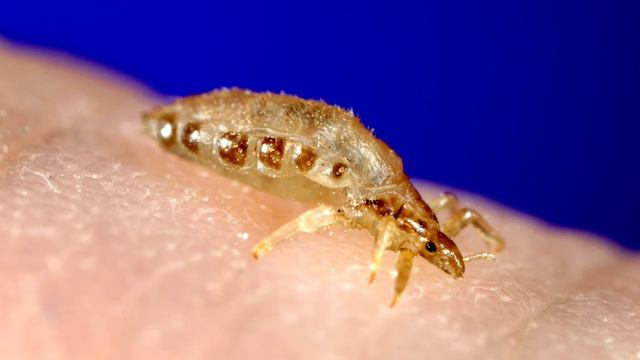 Твари окаянные рассказ о вшах из книги М.Козлова Не просто букашки смотреть онлайн