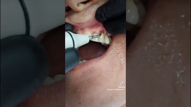 ТИШЛАРДА КУМИРГА АЙЛАНГАН ТОШЛАР ! МОСКВА +79636579707 ВАТСАП смотреть онлайн