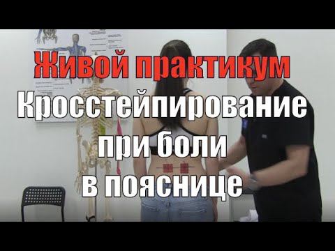 Кросстейпирование при боли в пояснице с самодиагностикой смотреть онлайн