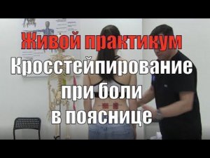 Кросстейпирование при боли в пояснице с самодиагностикой