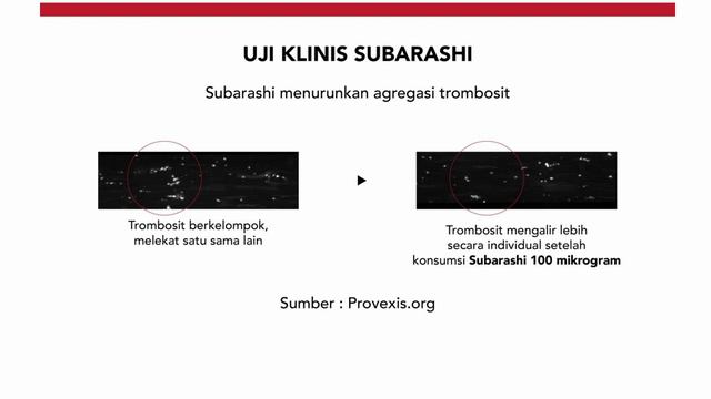 SOP SUBARASHI PENYEMPURNAAN DARI SOP100+ смотреть онлайн