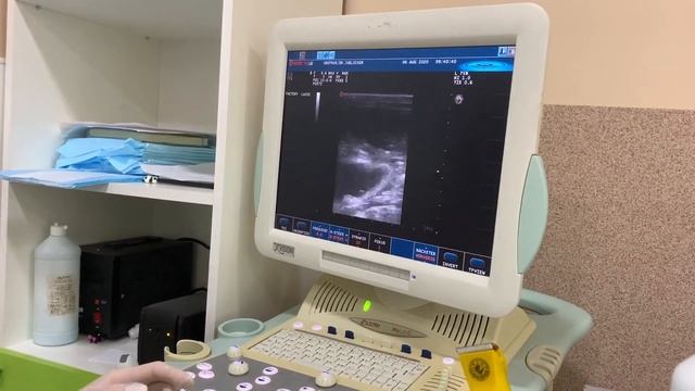 Pregnant Cat 5 Days Before Giving Birth. We Do An Ultrasound