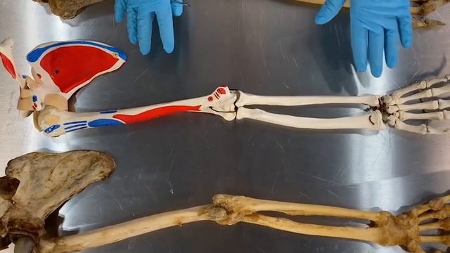 История возникновения пилатес: интриги, суды и подковёрная борьба ! смотреть онлайн