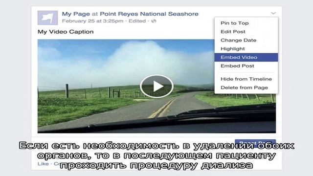 Опухоли в почке смотреть онлайн