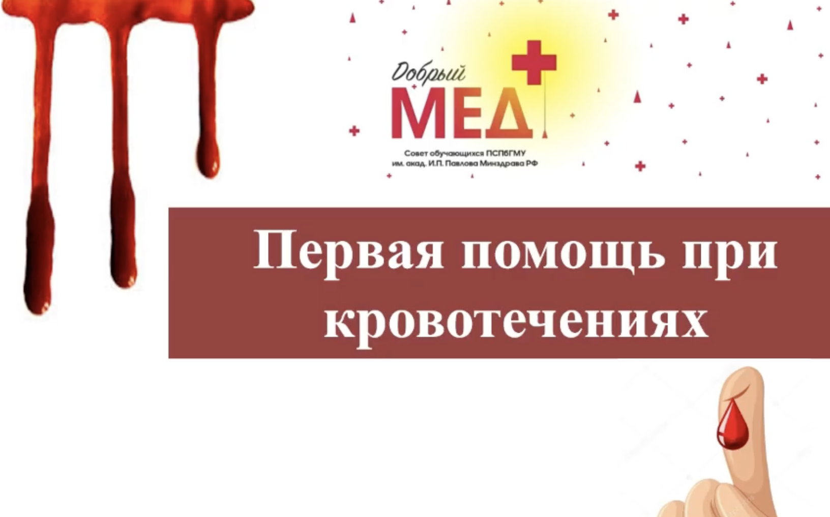 Первая помощь при кровотечениях смотреть онлайн