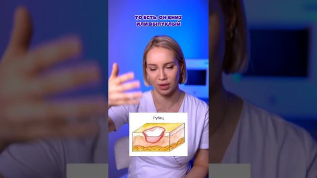 Как убрать рубцы и шрамы? смотреть онлайн