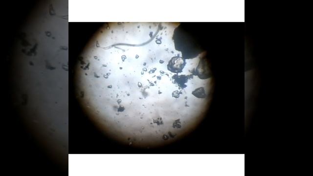 И кто там живёт в луже??? круглые черви под микроскопом. Зачем нужно мыть руки смотреть онлайн