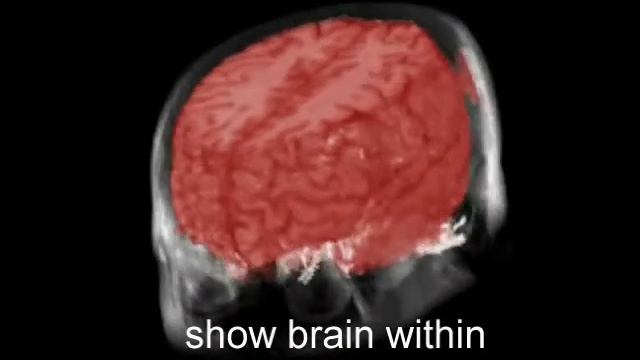 RTVR-A Flexible Java Library for Interactive Volume Rendering by Mroz and Hauser смотреть онлайн