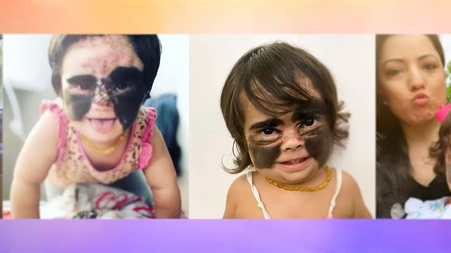 Luna: Our Baby With A Giant Birthmark | BORN DIFFERENT смотреть онлайн