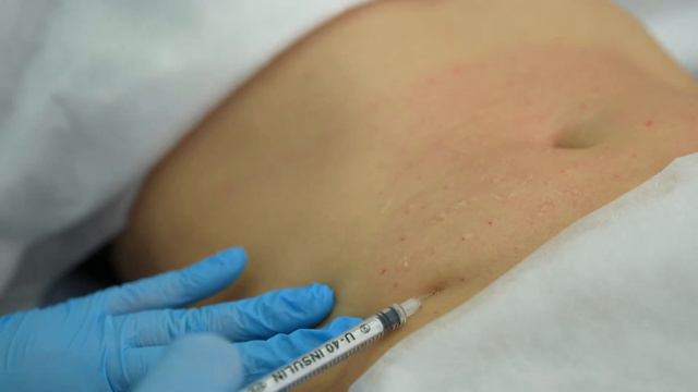 Секрет красоты: Мезотерапия для идеального живота смотреть онлайн