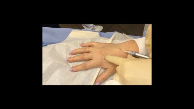 Обучение "Коррекция кистей рук в технике "Мезо Радиесс по Юцковской" смотреть онлайн