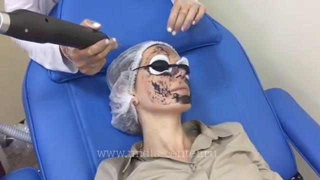 Фракционный неодимовый лазер ? MERMAID ? RUIKD KOREA смотреть онлайн