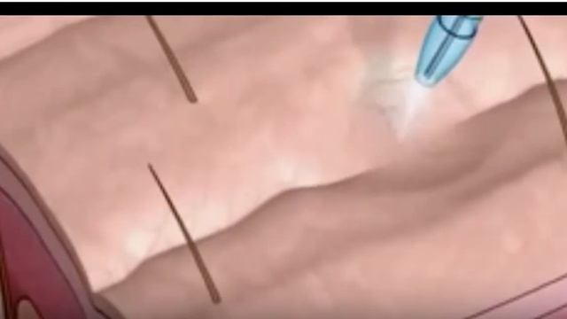 Jet peel смотреть онлайн